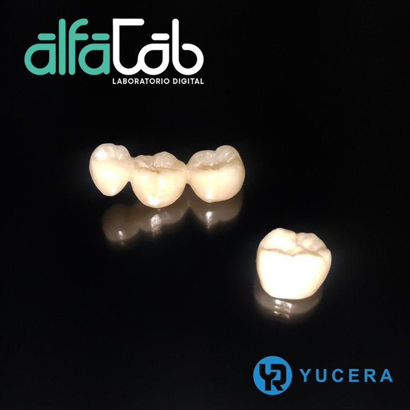 Yucera 4D Pro Super Duurzame Tandheelkundige Zirkoniumblok Compatibel met CAD CAM Systeem voor Precieze Restauratie en een Verfriste Glimlach