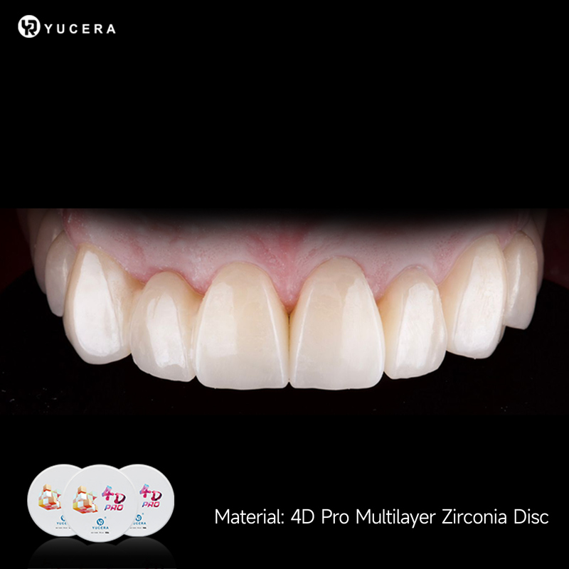 Yucera Full Contour Monolithic 98mm Pre Sintered Blank Multilayer ST ML for Bridge Framework Zirconia Block Multilayer