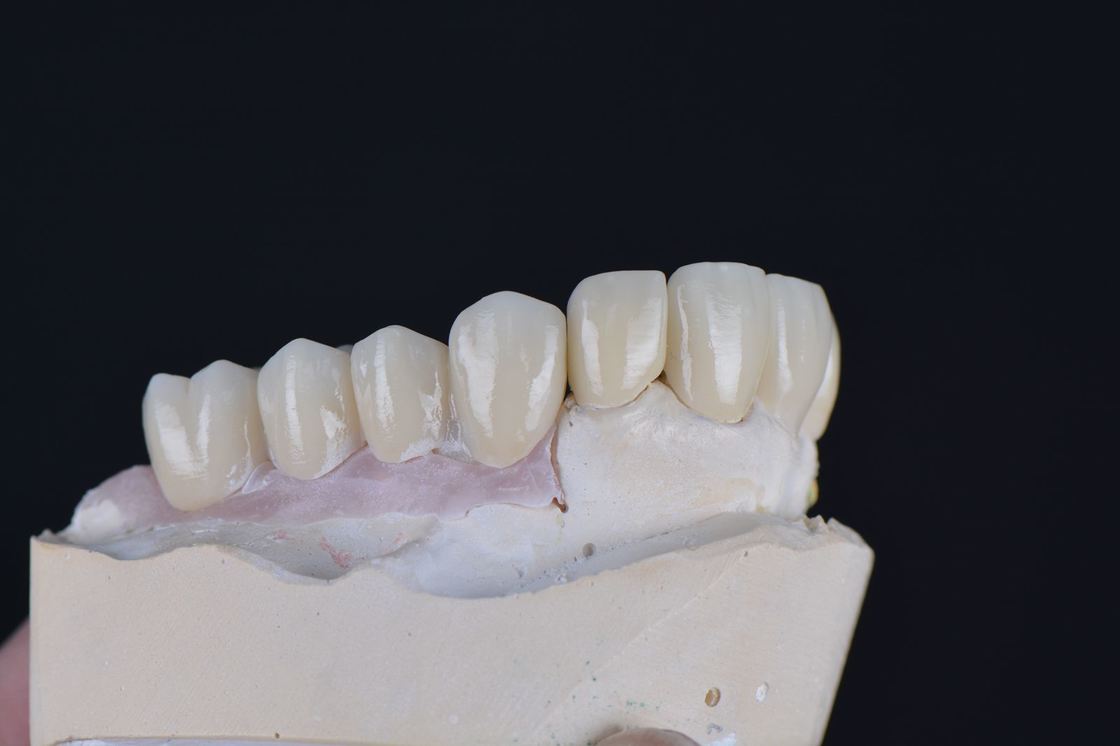 43%-57% Translucency 700-1200 MPa Bending Strength YUCERA Dental 89mm CAD/CAM 4D Pro Multilayer Zirconia Block