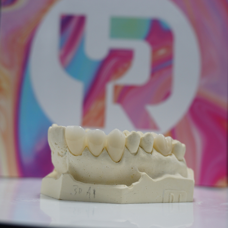 Yucera 16mm 4D Pro  Multilayer Dental Zirconia Blocks  for Open System Milling Machine
