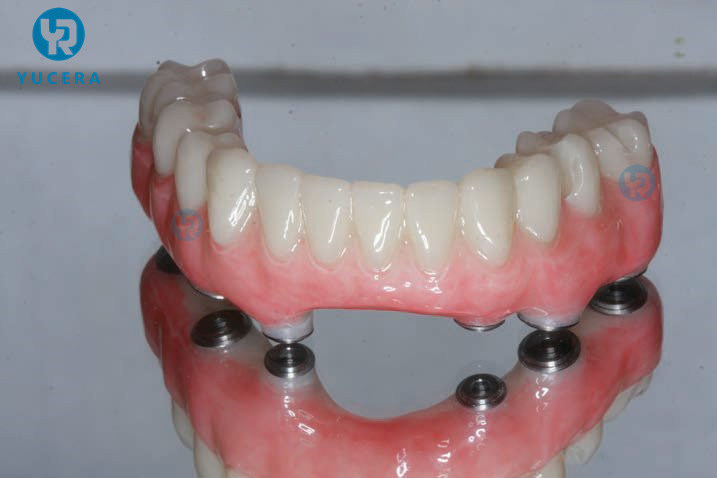 Dental Material Pmma Blocks Dental Zirconia Disc Open System for Lab Dental