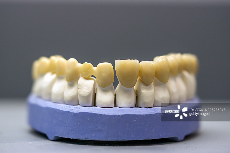 Vertrouw op Yucera STwhite Zirconia Materialen voor Duurzame en Esthetisch Superieure Tandheelkundige Resultaten