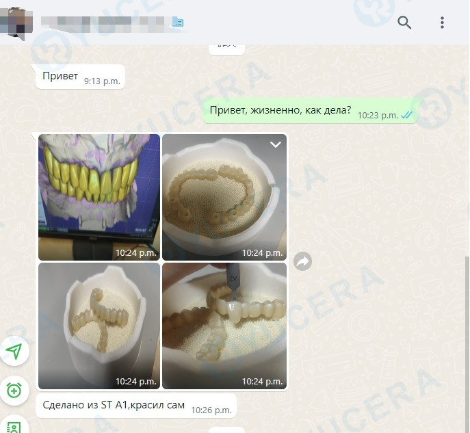 Yucera 4D Pro High - Precisie 3D Multilayer Tandheelkundige Zirkoniumblok Stabiel en Betrouwbaar Creëert Ideale Restauratieresultaten