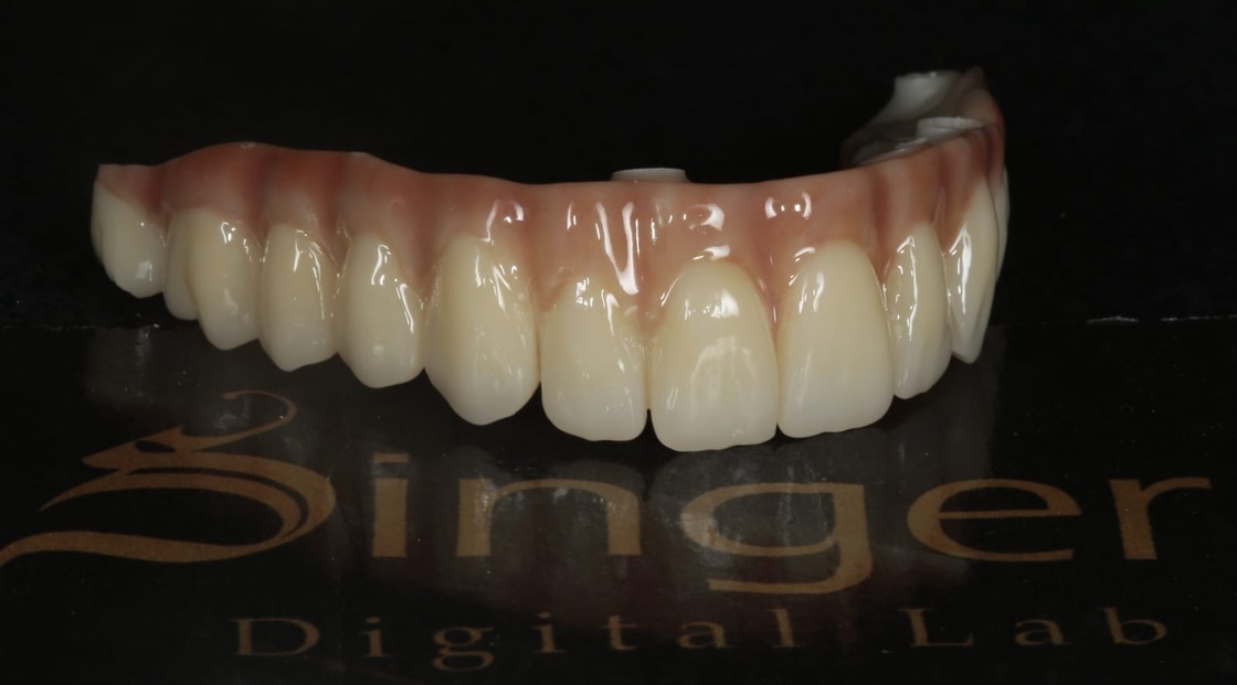 Yucera 4D Pro Multilayer Kleurverloop Tandheelkundige Zirconia Schijf met Standaard Kleuren van A1/A2/A3