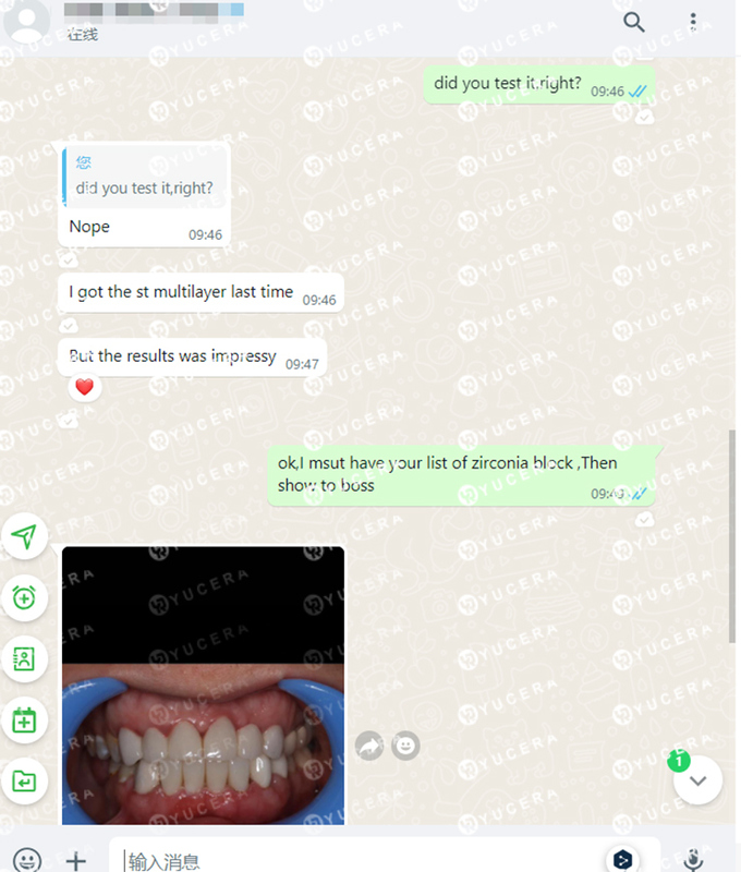 Yucera 4D Pro Dental Zirconia Blokken - Precisie Vervaardigd voor Tandtechnische Laboratoria